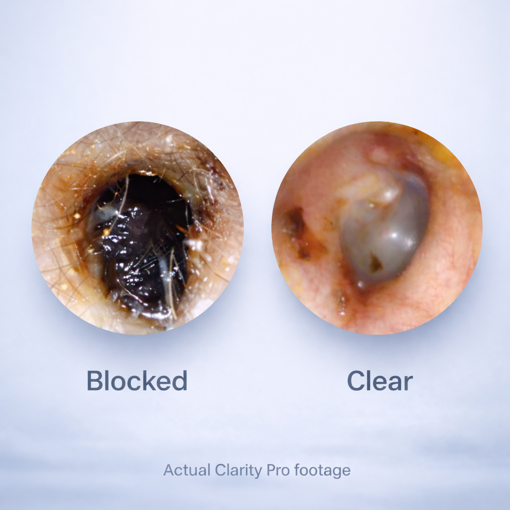 Clarity Pro - Ear Cleaner